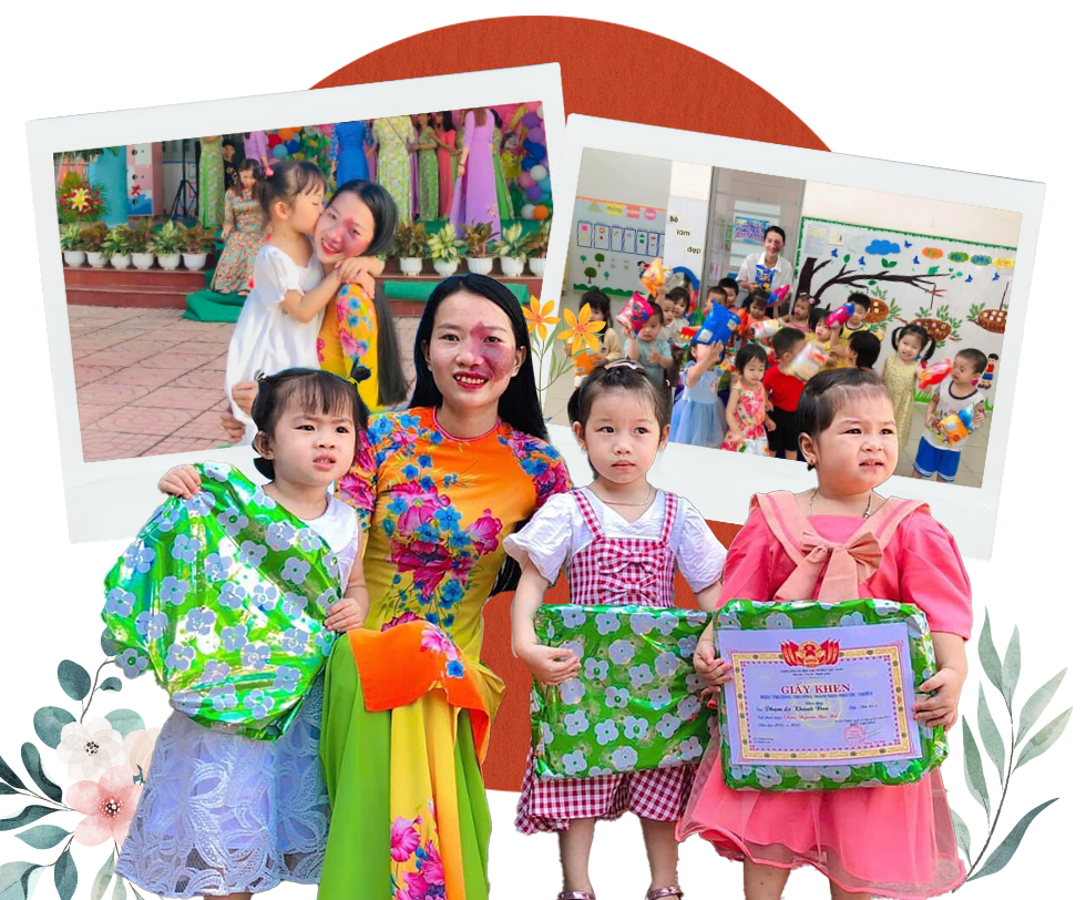 Cô giáo trẻ sống vui vẻ, tự tin với vết bớt chiếm một phần tư gương mặt - 13 Cô giáo trẻ sống vui vẻ, tự tin với vết bớt chiếm một phần tư gương mặt - 13