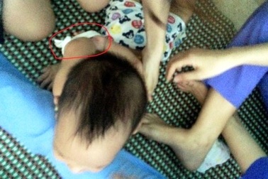 Vụ trẻ bị cô giáo trói tay chân: Xử phạt 22,5 triệu đồng, giải thể Mầm non Sơn Ca