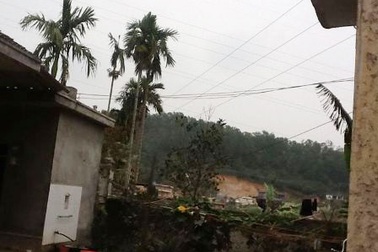 Bị điện giật bỏng nặng, nửa tháng sau mới được nhập viện