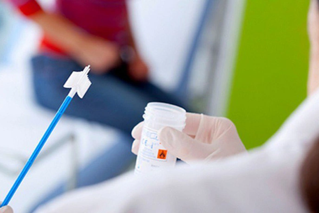 Phát hiện sớm ung thư cổ tử cung bằng cách nào? - 2 Phát hiện sớm ung thư cổ tử cung bằng cách nào? - 2
