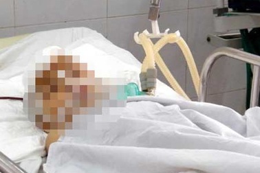 Trèo cửa sổ xem múa lân, cháu bé 5 tuổi rơi từ tầng 3