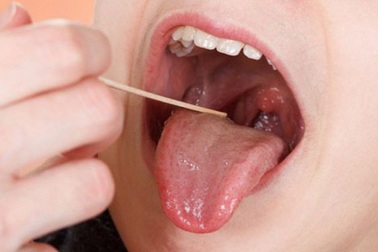 Những dấu hiệu cảnh báo ung thư vòm họng dễ nhầm lẫn với bệnh vặt