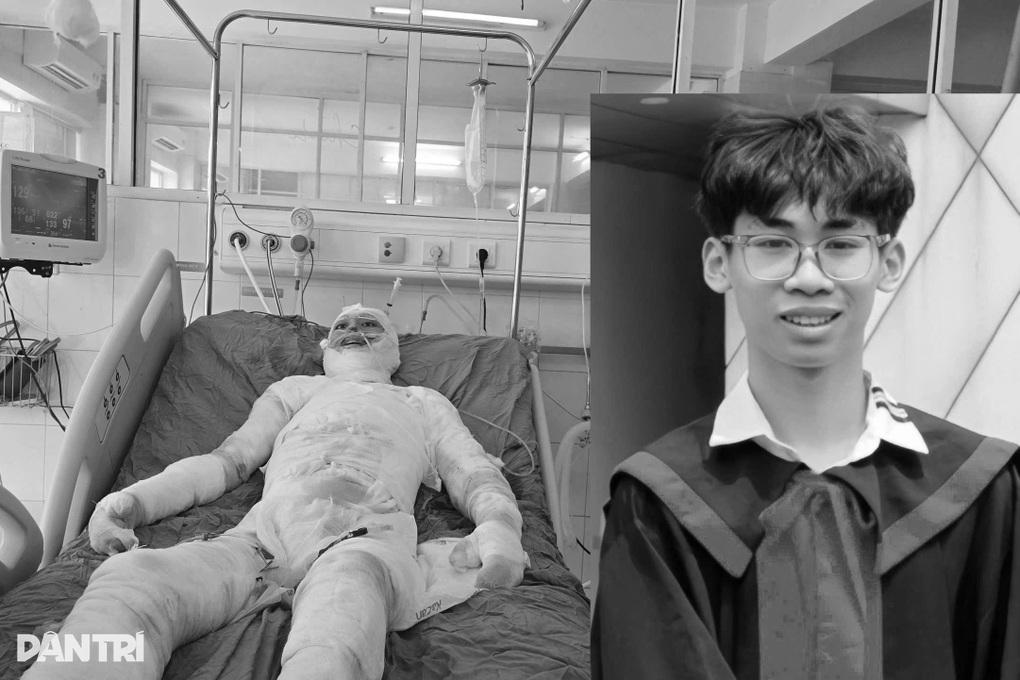 Chàng trai 19 tuổi bỏng 86% cơ thể đã không qua khỏi - 1