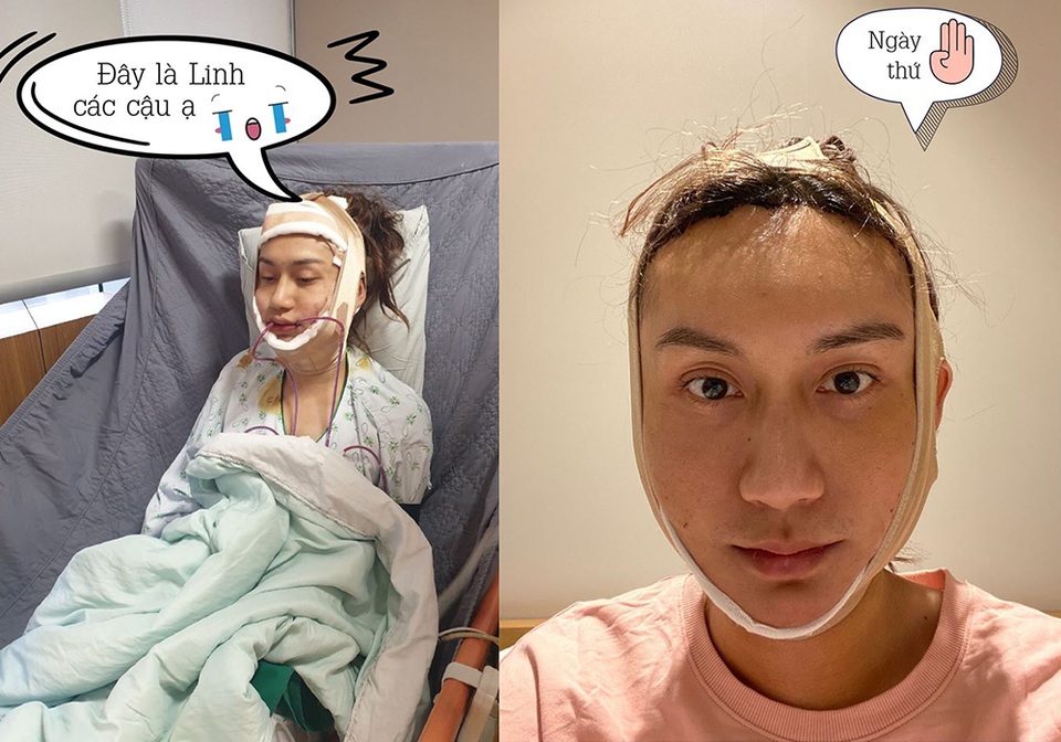 Lynk Lee công khai hành trình chuyển giới - 3 Lynk Lee công khai hành trình chuyển giới - 3