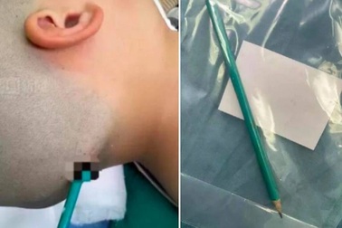 Cáu giận lúc dạy con học bài, người cha ân hận vì suýt làm con mất mạng