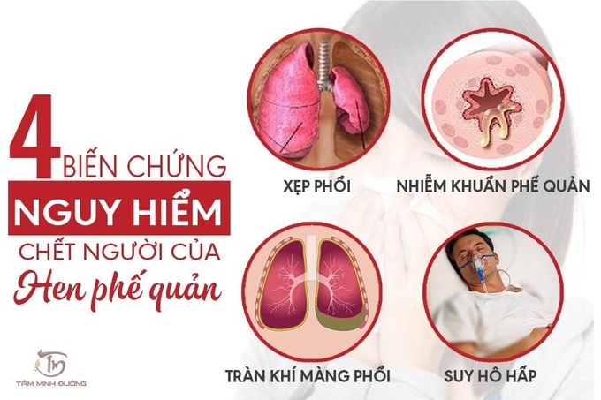 Lưu ý khi chăm sóc người bệnh hen suyễn tại nhà trong mùa dịch - Ảnh 3.