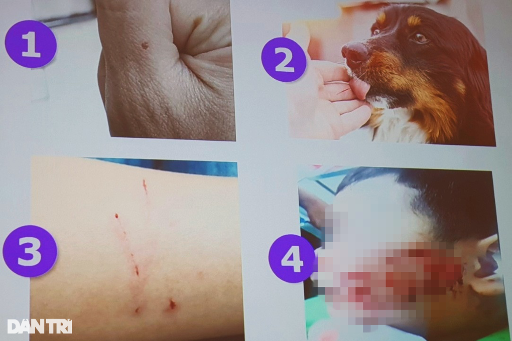 Người đi tiêm ngừa dại tăng 300%: Cảnh báo những sai lầm khi bị chó mèo cắn - 2 Người đi tiêm ngừa dại tăng 300%: Cảnh báo những sai lầm khi bị chó mèo cắn - 2
