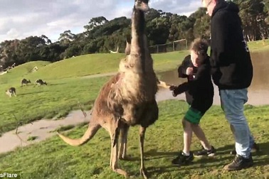 Du khách nhí bất ngờ bị kangaroo đá vào mặt