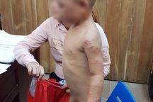 Cha dượng ra tay đánh bé 3 tuổi dã man