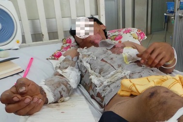 Máy bơm thuốc bị rò xăng, nam thanh niên thành “đuốc sống”