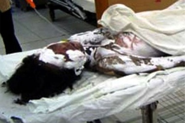 Khởi tố người chồng dùng xăng đốt vợ