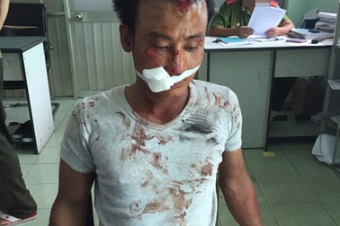 Bắt giữ kẻ“ngáo đá” chém nhiều người dân