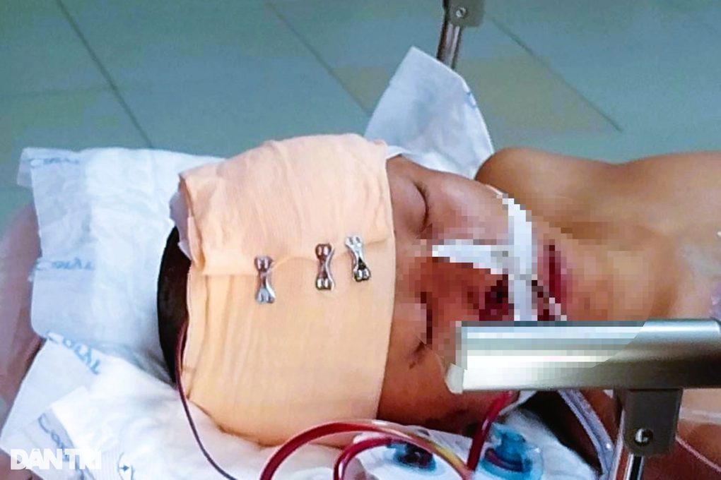 Tranh thủ đi làm thêm dịp hè phụ cha mẹ, nam sinh lớp 11 gặp nạn nguy kịch - 2 Tranh thủ đi làm thêm dịp hè phụ cha mẹ, nam sinh lớp 11 gặp nạn nguy kịch - 2