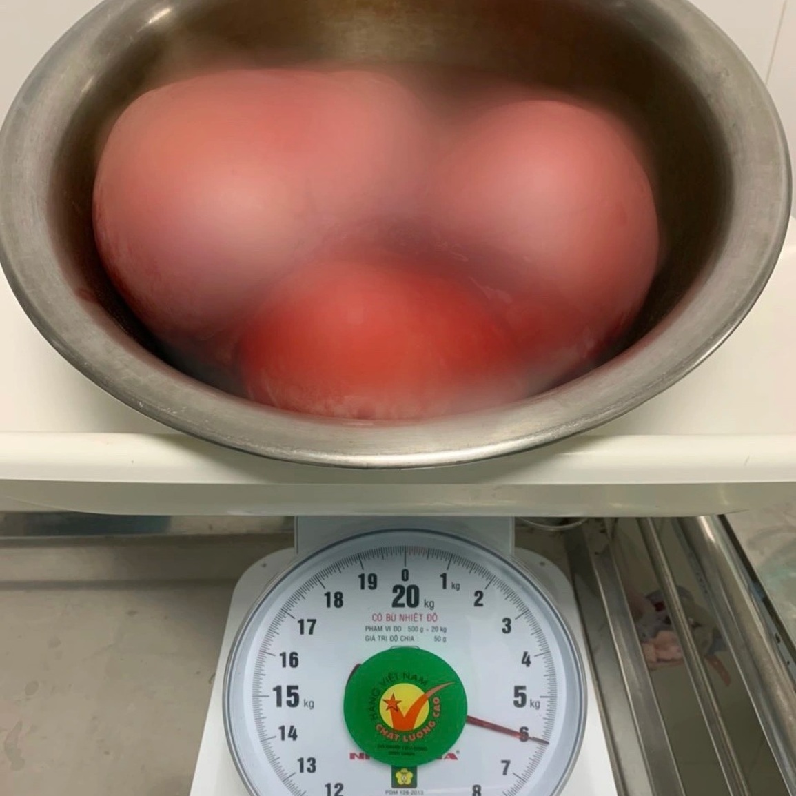 Phẫu thuật khối u xơ nặng 5,5 kg cho người phụ nữ 35 tuổi - 1 Phẫu thuật khối u xơ nặng 5,5 kg cho người phụ nữ 35 tuổi - 1