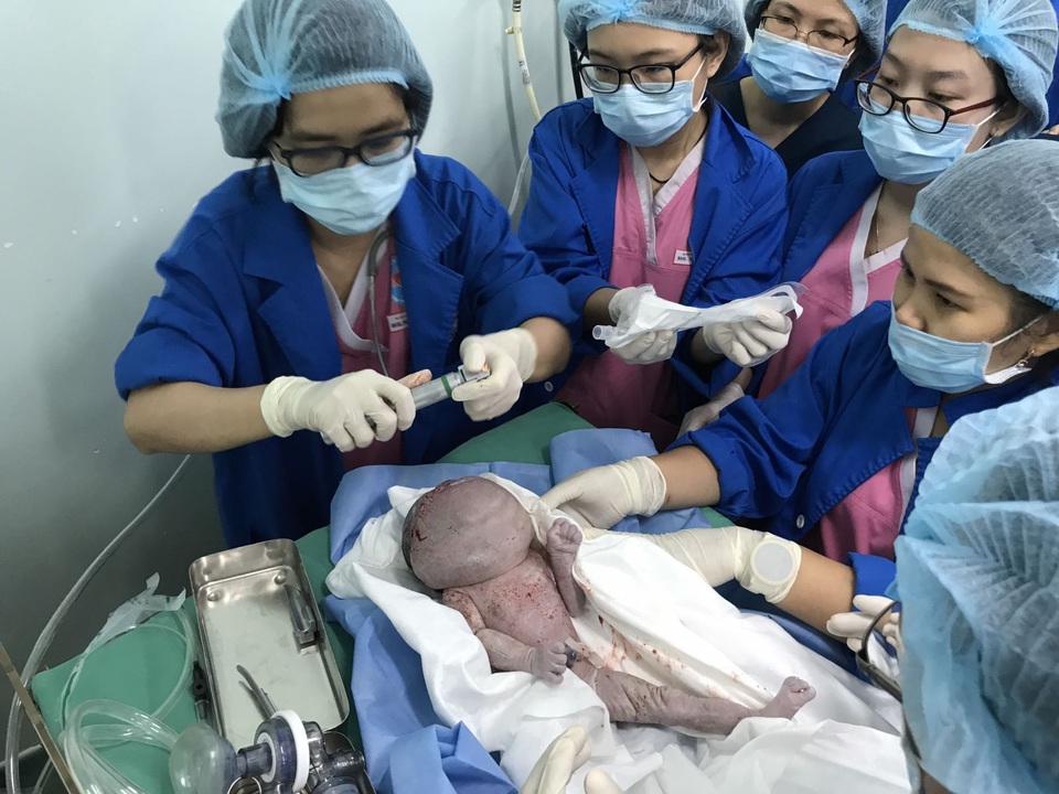Bé gái sơ sinh mang khối u khổng lồ hiếm gặp - 2 Bé gái sơ sinh mang khối u khổng lồ hiếm gặp - 2