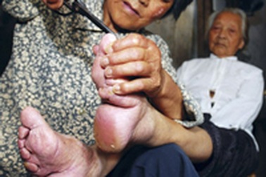 Những nạn nhân cuối cùng của tục bó chân Trung Quốc