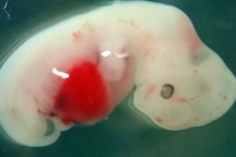 Các nhà khoa học đã thực hiện thành công phôi lai giữa… người và cừu