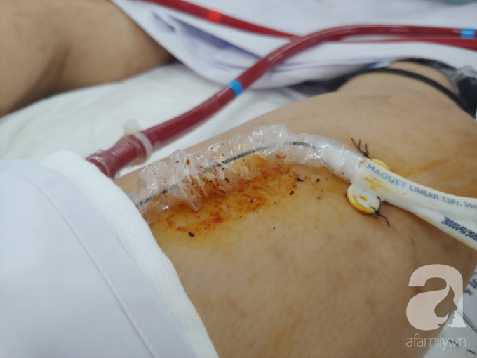 Thương tâm: Sản phụ ngưng tim nguy kịch lúc lâm bồn, chồng uất nghẹn tìm 400 triệu để vợ về nhìn mặt con đầu lòng - Ảnh 6. Thương tâm: Sản phụ ngưng tim nguy kịch lúc lâm bồn, chồng uất nghẹn tìm 400 triệu để vợ về nhìn mặt con đầu lòng - Ảnh 6.
