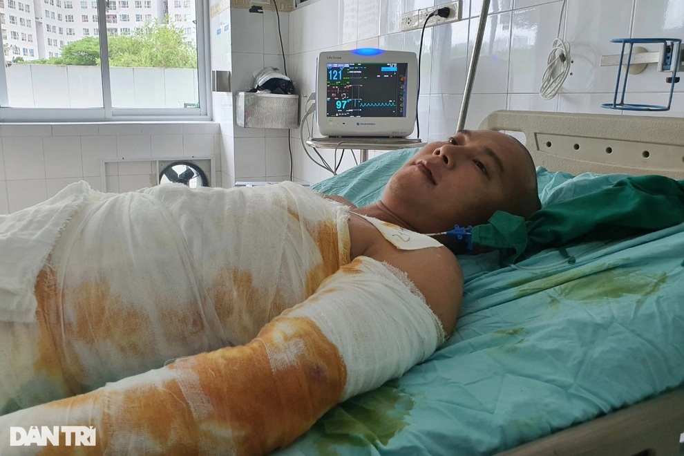 Thương người đàn ông cháy như bó đuốc sau cú phóng điện cao thế oan nghiệt - 3 Thương người đàn ông cháy như bó đuốc sau cú phóng điện cao thế oan nghiệt - 3