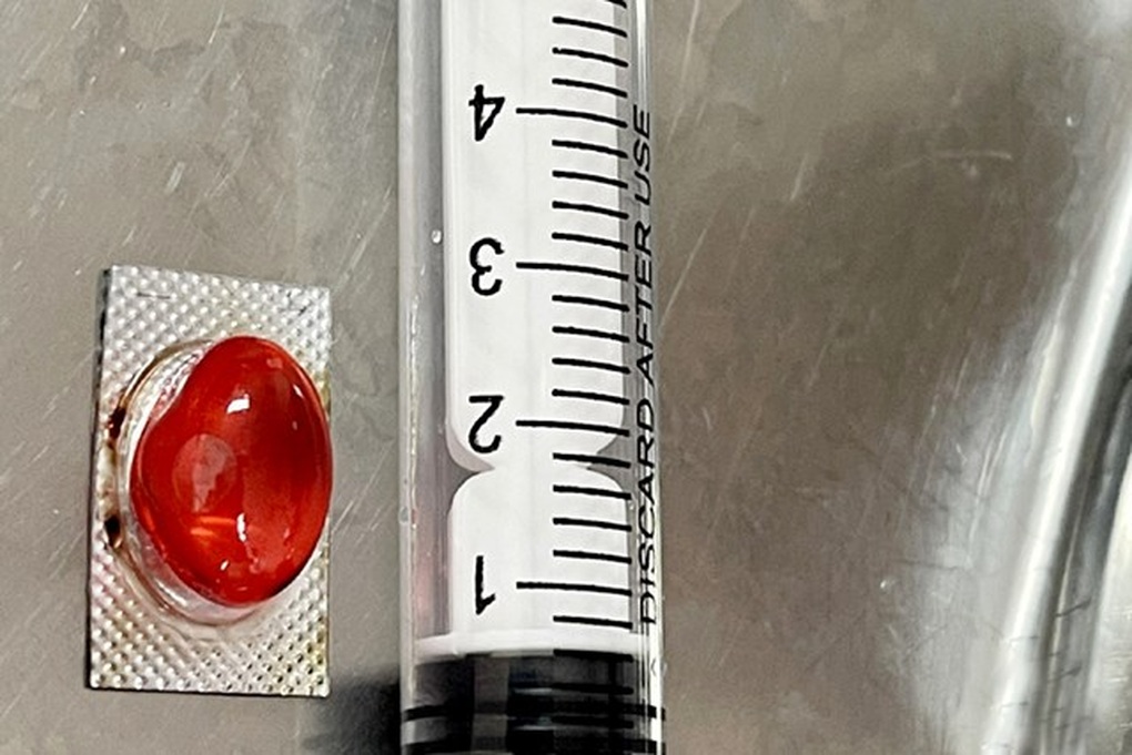 Người đàn ông nhập viện vì uống thuốc quên bóc vỏ - 1 Người đàn ông nhập viện vì uống thuốc quên bóc vỏ - 1