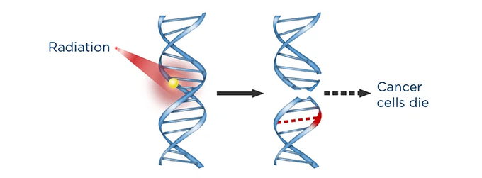 Xạ trị bằng hiệu ứng lượng tử giúp tiêu diệt tế bào ung thư chỉ trong 3 ngày - Ảnh 2.