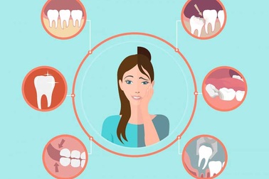 Inforgraphic: Những điều cần biết về răng khôn