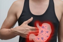 Học cách của người Nhật để phát hiện sớm ung thư dạ dày