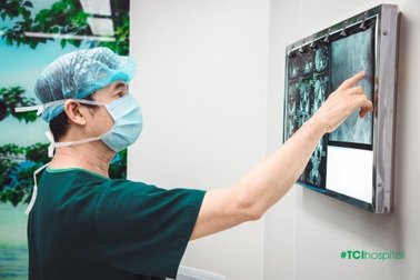 Sỏi thận 6cm cùng 3 viên sỏi khác được lấy sạch trong một lần điều trị