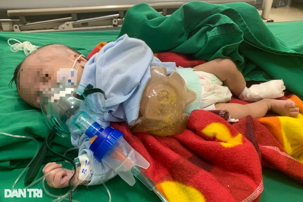 Con gái 2 tháng tuổi chết mòn vì bệnh tật, người mẹ mong một phép màu - 1 Con gái 2 tháng tuổi chết mòn vì bệnh tật, người mẹ mong một phép màu - 1