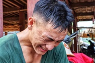 Người lính bị đinh cắm xuyên chân khi tìm thi thể tại Làng Nủ