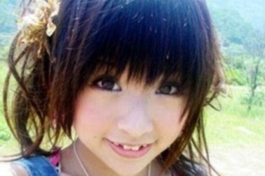 Nhật Bản: Thiếu nữ rộ mốt làm đẹp... răng ma cà rồng