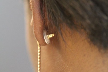 Phụ nữ sắp có thể tránh thai nhờ… đeo đồ trang sức