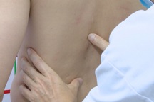 Đi thầy lang nắn bẻ khớp trị đau lưng, người đàn ông 35 tuổi gãy xương nặng