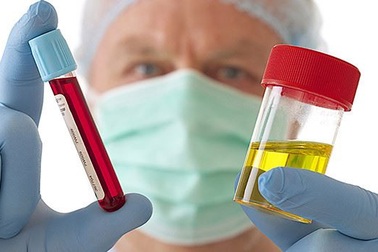 Tiểu ra máu có thể gặp ở ung thư bàng quang