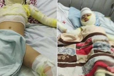 Bố nướng mực bằng cồn, con 2 tuổi tử vong, 3 người nguy kịch