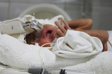 Cháu bé sinh non từ người mẹ phát bệnh dại đã qua đời