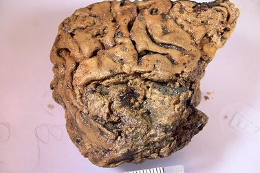 Bí ẩn não người cổ đại tồn tại nguyên vẹn trong 2.600 năm không phân huỷ