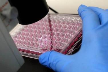 Phát hiện nguyên nhân gây ung thư di căn