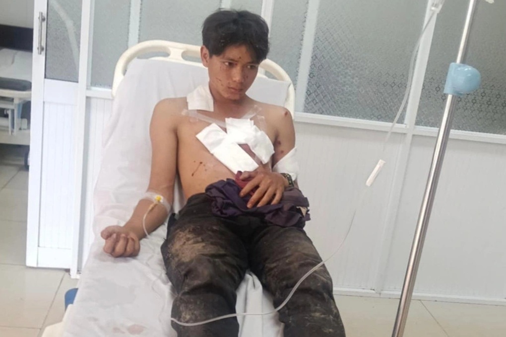 Nổ mìn tự chế khi đi đánh cá, 2 thanh niên bị thương nặng - 1 Nổ mìn tự chế khi đi đánh cá, 2 thanh niên bị thương nặng - 1