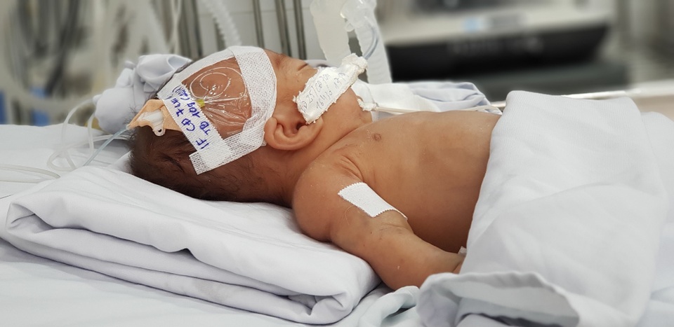 Bé trai bị bỏ rơi trước cổng chùa đang viêm phổi, nhiễm trùng huyết - 2