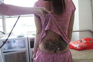 Bị cha mẹ đánh dã man vì… không chịu lấy chồng