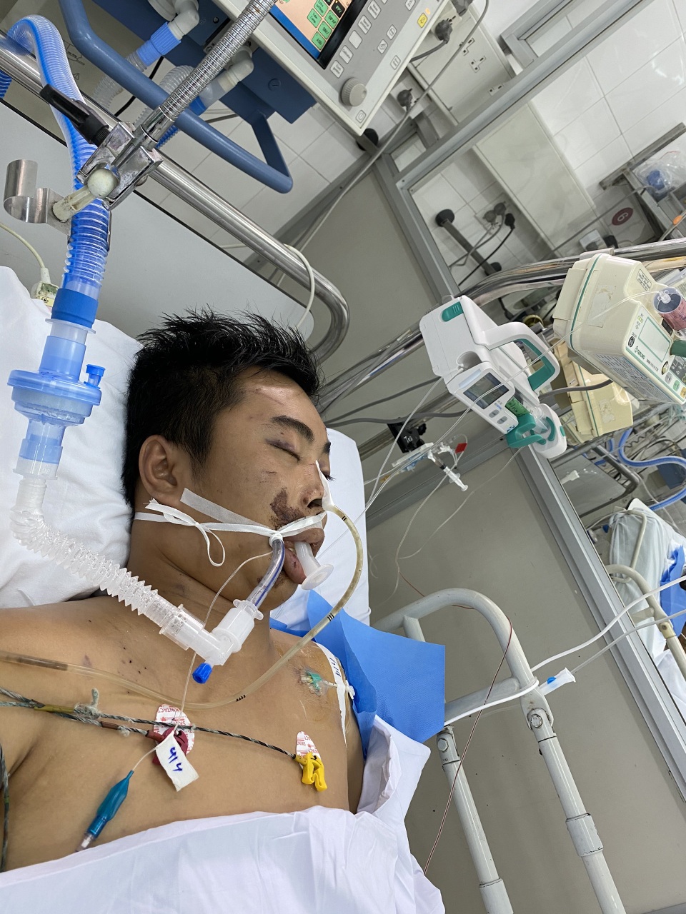 Hoàn cảnh chàng trai hăng hái chống giặc Covid - 19 gặp nạn nguy kịch - 5 Hoàn cảnh chàng trai hăng hái chống giặc Covid - 19 gặp nạn nguy kịch - 5