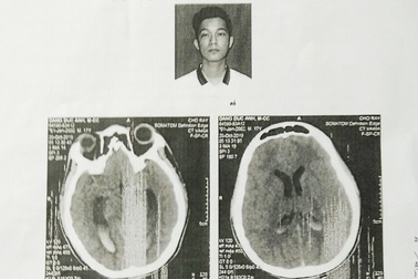 Vụ nam sinh bị đánh chấn thương não: Công an lý giải nguyên nhân chậm trễ