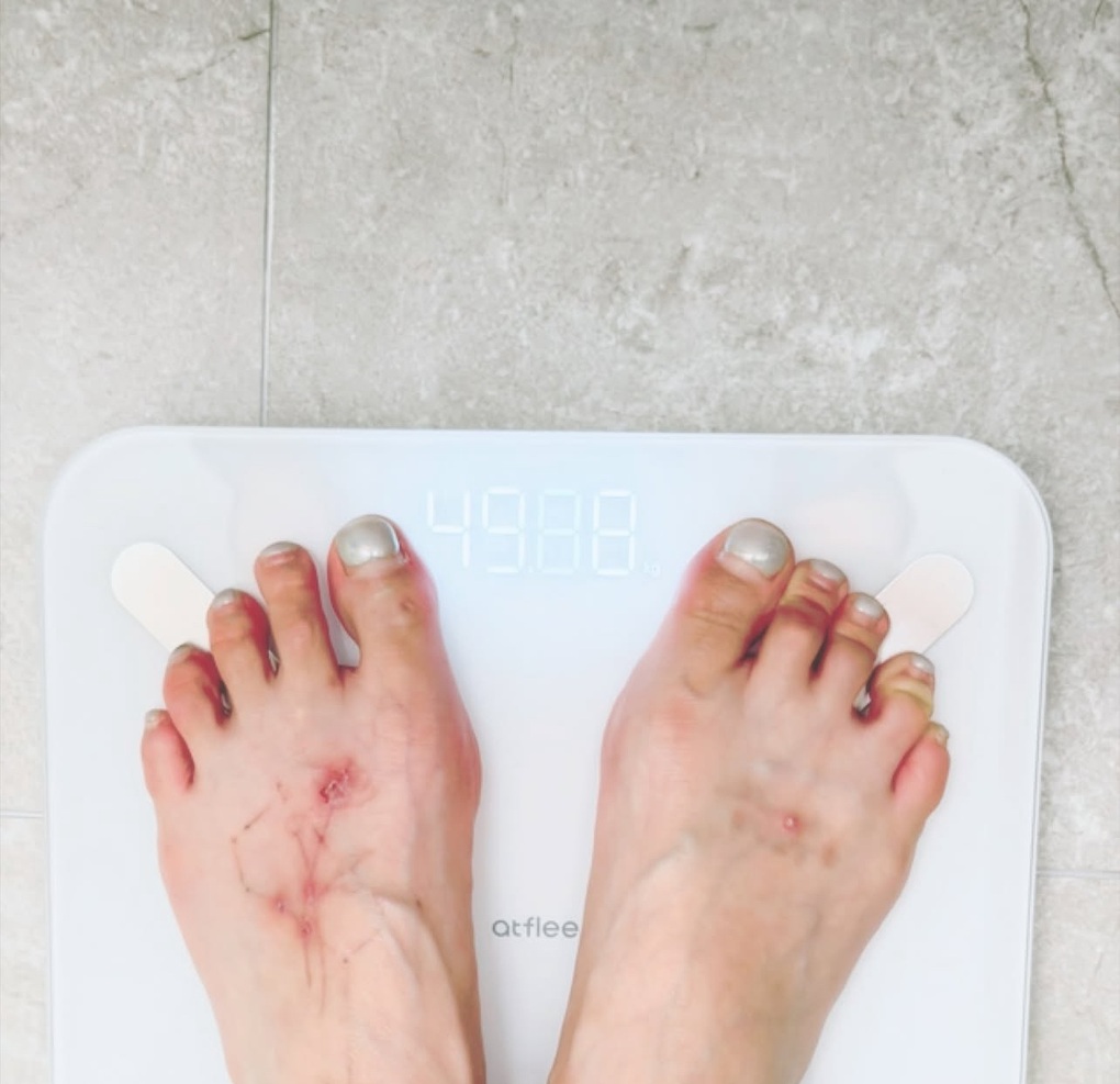 HyunA ngất xỉu trên sân khấu sau khi giảm 10kg trong thời gian ngắn - 1