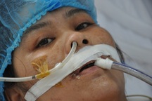 Bị tường đổ vào, người phụ nữ trẻ vỡ tim, nguy kịch tính mạng