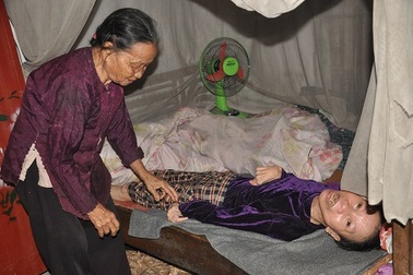 Cô gái xinh đẹp thành người tàn phế sau khi bị rắn cắn