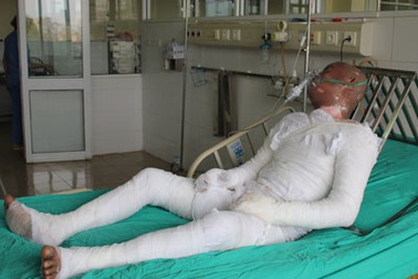 Nạn nhân vụ nổ bình gas đã tử vong