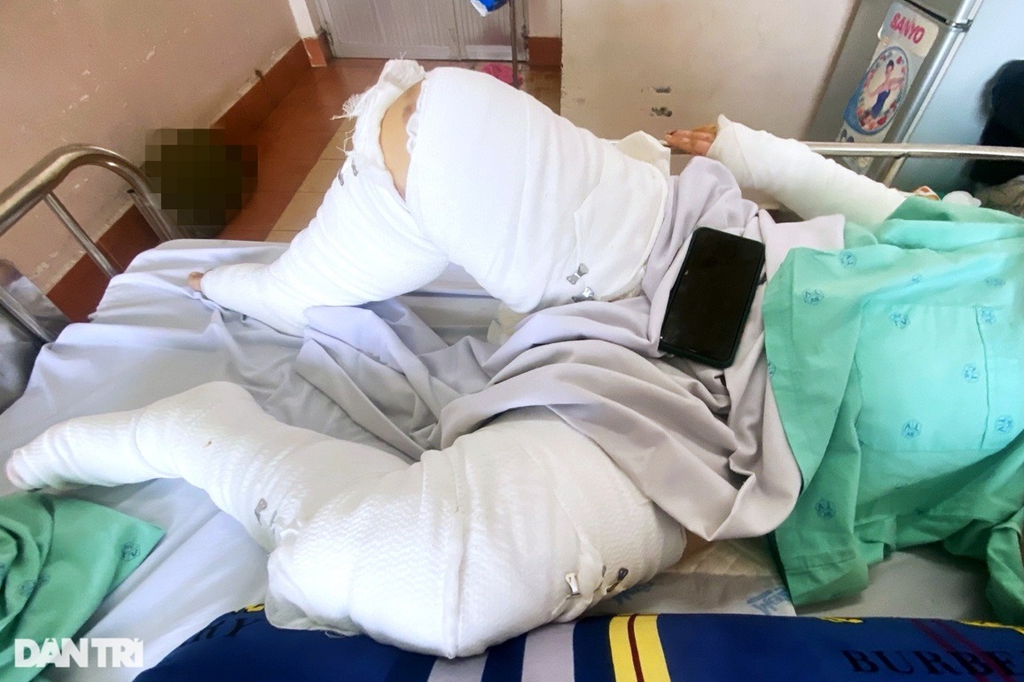 Vợ gần sinh và con trai bỏng nặng vì chồng đá trúng chai cồn vào người - 1 Vợ gần sinh và con trai bỏng nặng vì chồng đá trúng chai cồn vào người - 1