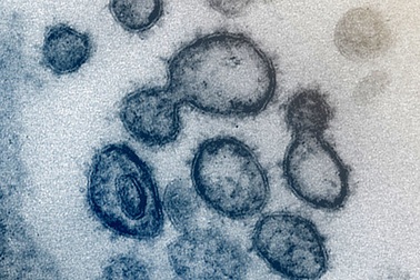 Thuốc điều trị HIV không hiệu quả với COVID-19?