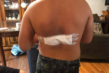 Cháy lưng vì sạc điện thoại phát nổ trong đêm